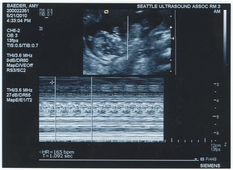 4704463070 9f05e54817 b.jpg?ixlib=rails 2.1