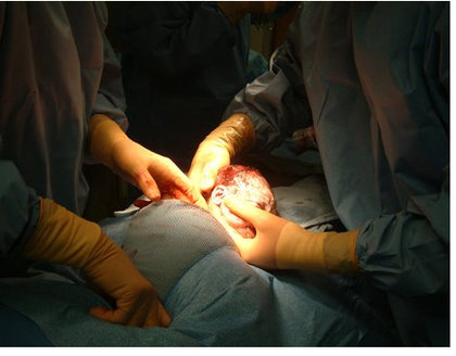 Rsz c section.jpg?ixlib=rails 2.1