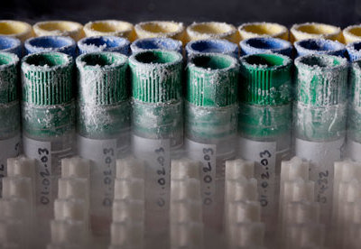 Rsz donor sperm stored in pla 007.jpg?ixlib=rails 2.1