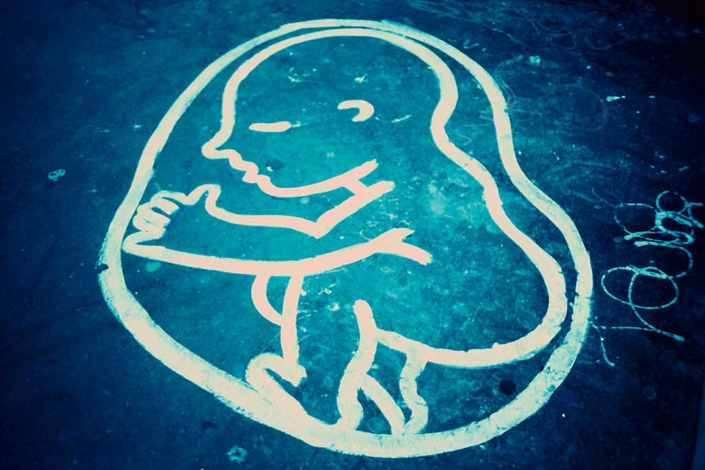 26167028572 073ac239f2 b.jpg?ixlib=rails 2.1