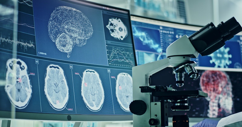 Brain and severe covid.jpg?ixlib=rails 2.1