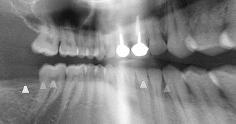 Teeth.jpg?ixlib=rails 2.1