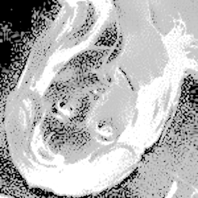 The Writing Bug Www Splicetoday