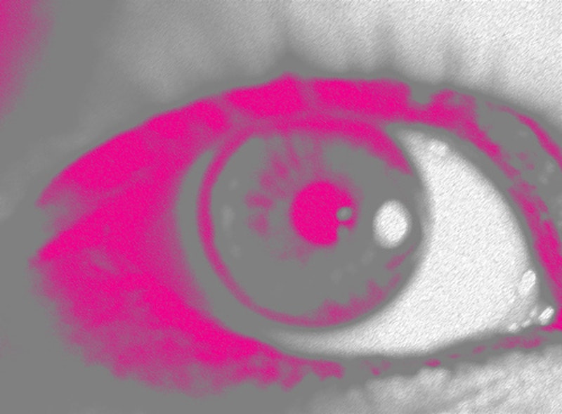 Pinkeye.jpg?ixlib=rails 2.1