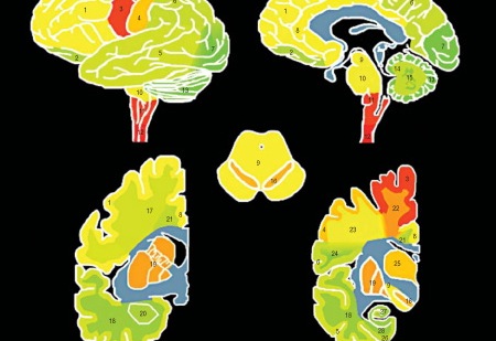Als brain heat map.jpg?ixlib=rails 2.1